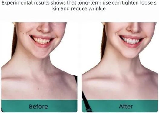 Bonjour Advanced Anti-Wrinkle & Electric Skin Lift Tool