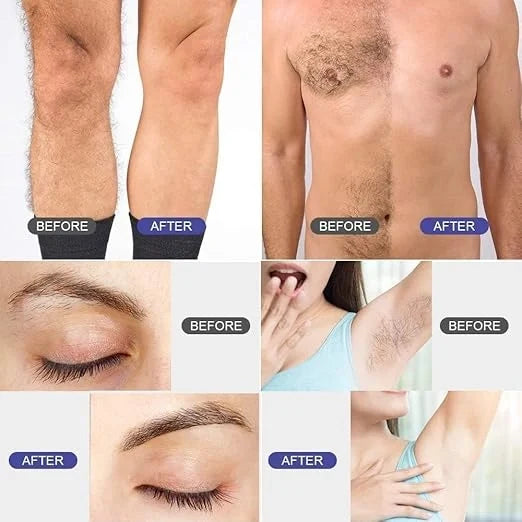 Wax Warmer Hair Removal Kit