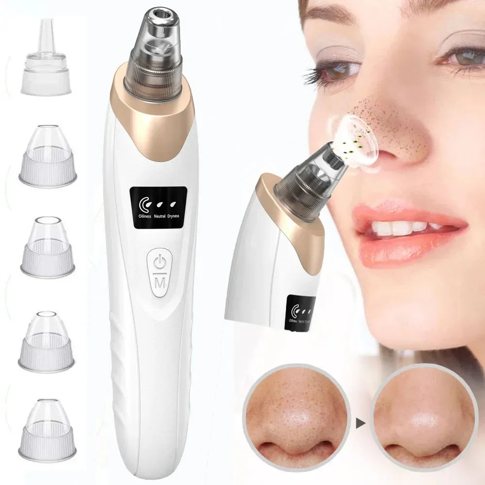 Electric Blackhead Remover Vacuum – Professional Pore Cleanser & Extraction Tool